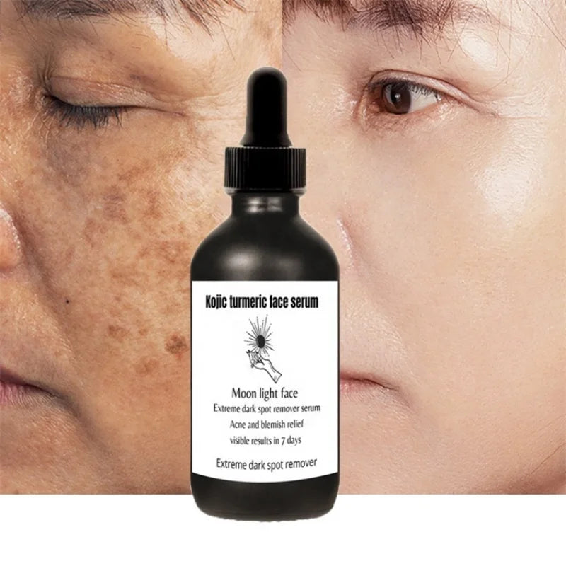 MOOYAM Kojic Turmeric Facial Serum - Laxe Online