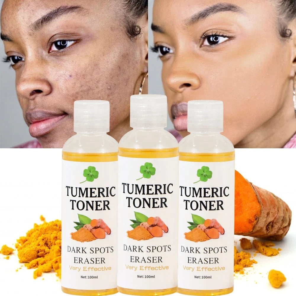 Turmeric toner - Laxe Online