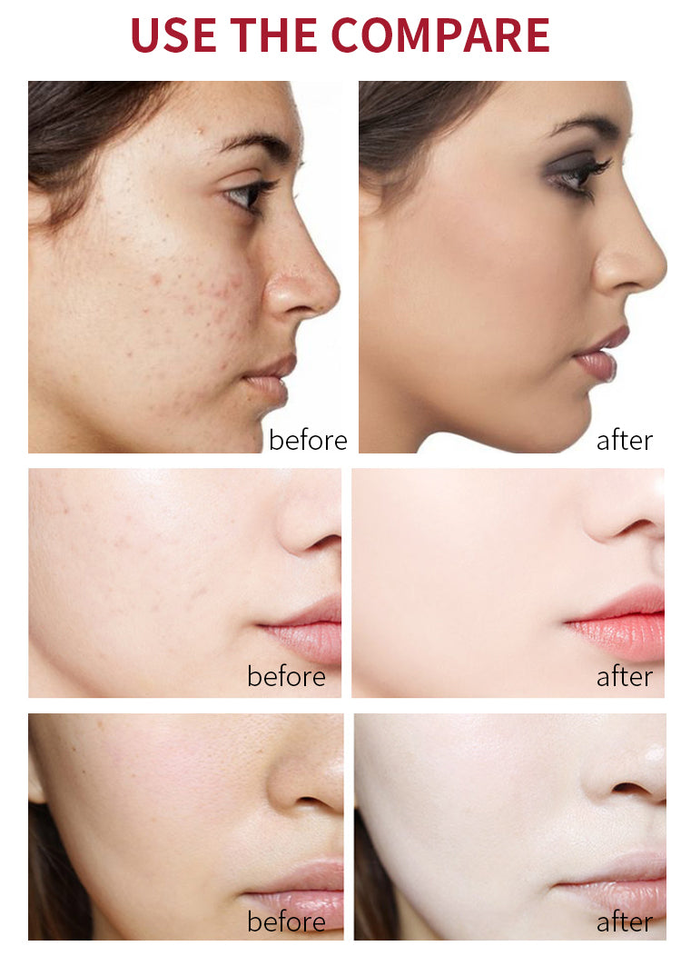 Arbutin serum - Laxe Online