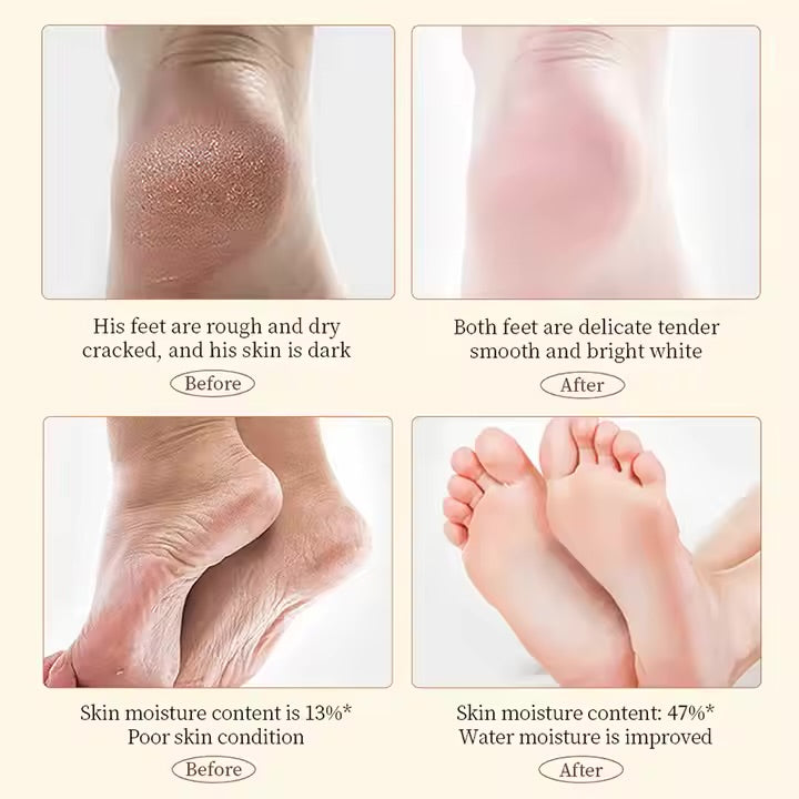Hand and Foot Cream