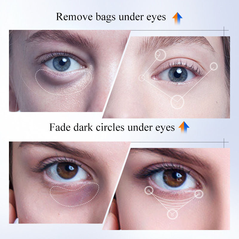 Anti-wrinkle eye cream