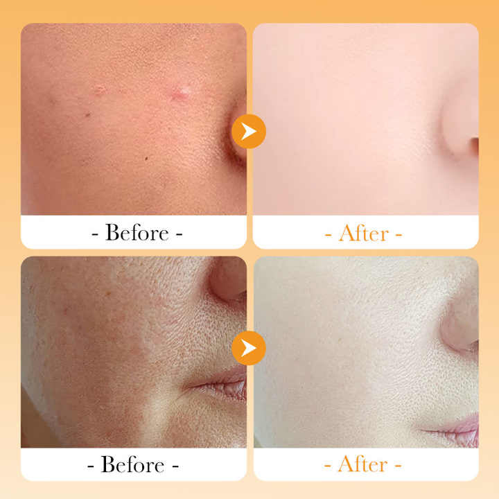 Vitamin C Whitening Toner spray