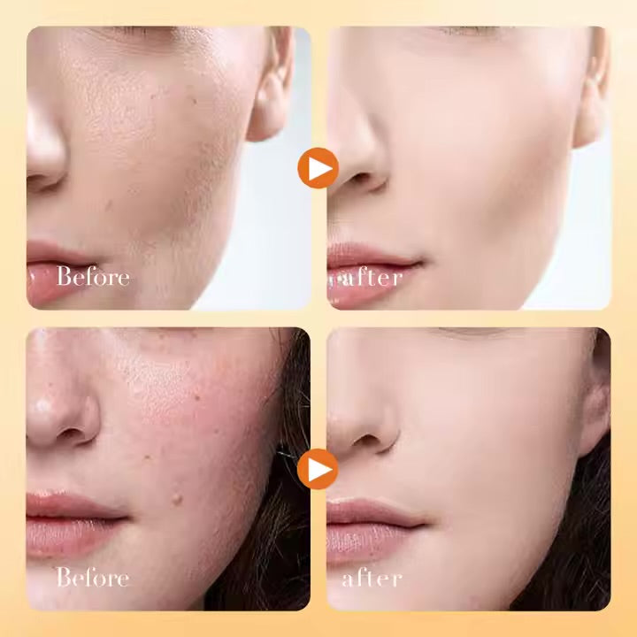 Vitamin c beauty cream