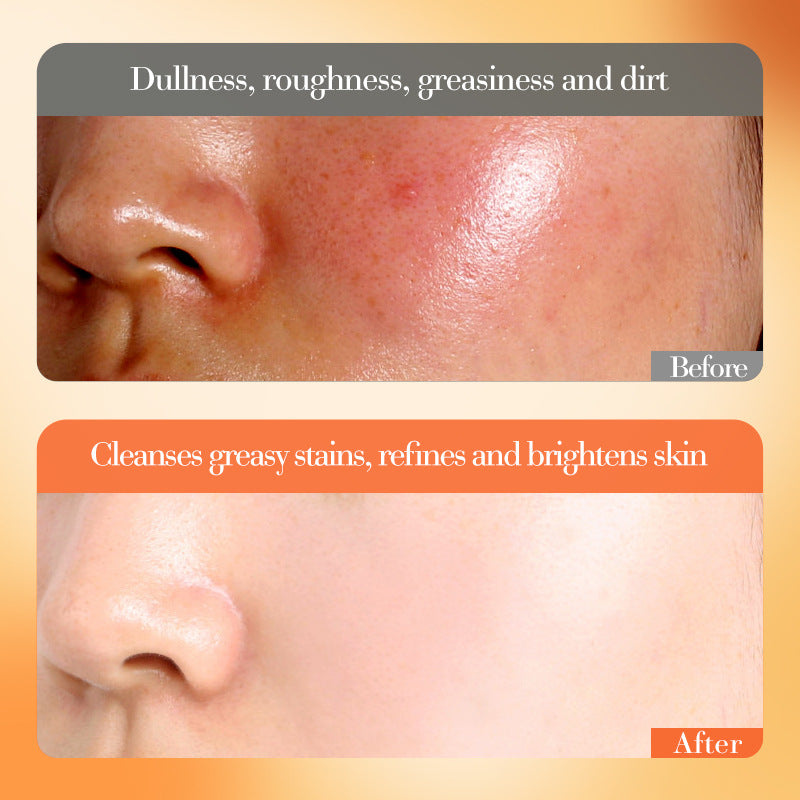 Vitamin C Whitening & Brightening Set