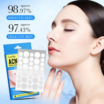 Acne patch
