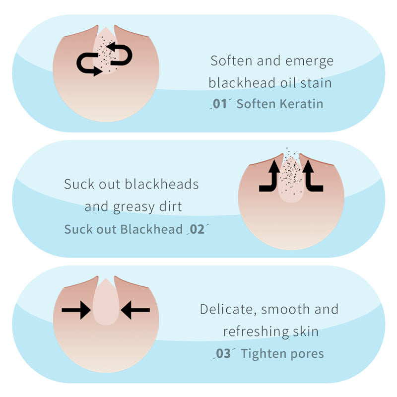 Aloe Vera Blackhead Remover Mask Se