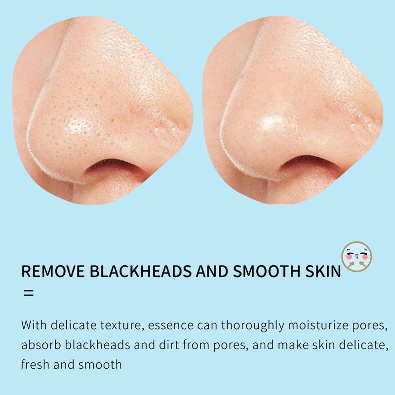 Aloe Vera Blackhead Remover Mask Se