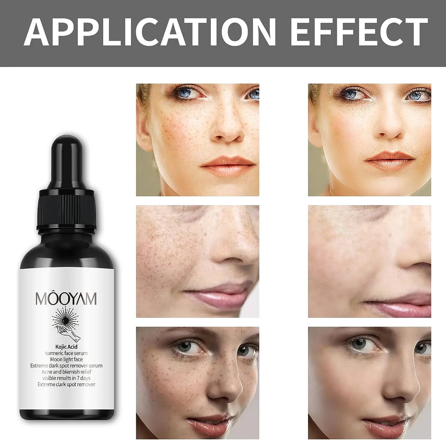 MOOYAM Kojic Turmeric Facial Serum - Laxe Online